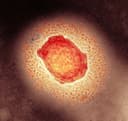 10+ monkeypox cases in US by October 31?