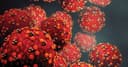300+ Measles cases in U.S. before April?