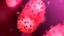 Confirmed case of monkeypox in US by Sep 30?
